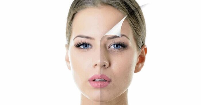Facial skin rejuvenation in women