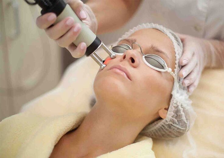 Laser skin rejuvenation procedures around the eyes